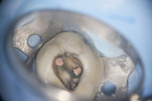 綾瀬（葛飾区小菅・堀切）の歯医者、あやせ ほりきり中央歯科口腔機能クリニックの保険診療で行う精密根管治療