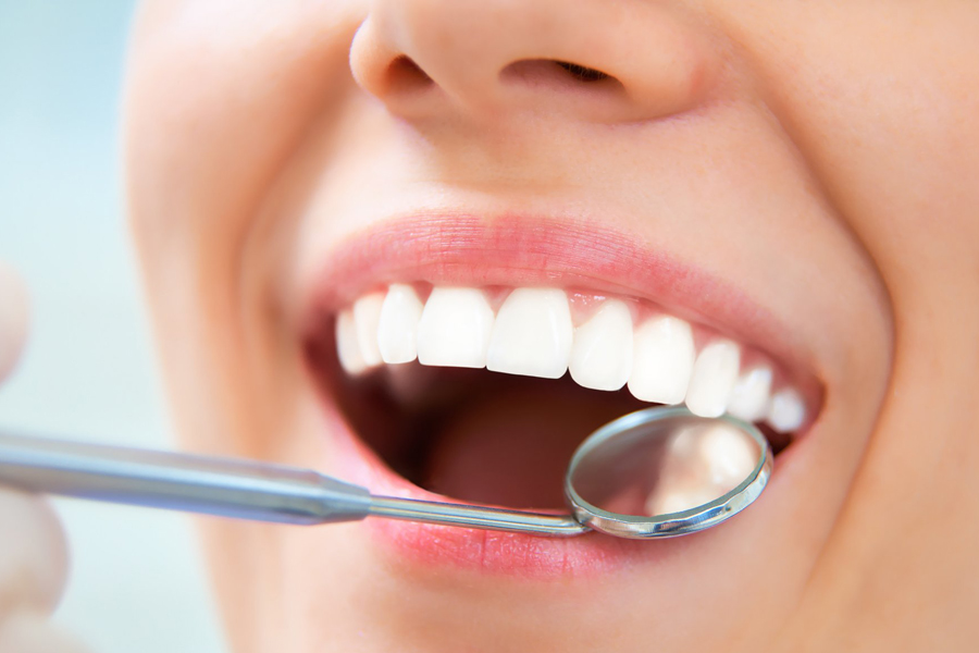 予防歯科 - 綾瀬（葛飾区小菅・堀切）の歯医者、あやせ ほりきり中央